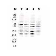 Anti-RFA2 pan reactive (RABBIT) Antibody, 100µg, Liquid (sterile filtered)