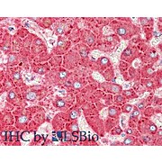 Anti-APOLIPOPROTEIN C-III (GOAT) Antibody, 1mg, Liquid (sterile filtered)