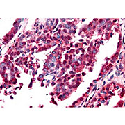 Anti-EGR-1 (RABBIT) Antibody, 100µg, Liquid (sterile filtered)