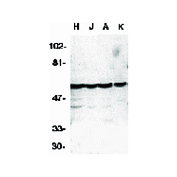 Caspase-10 Antibody 100µg