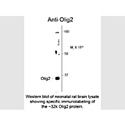 Anti-Olig2 (Rabbit) Antibody, 100µL, Liquid