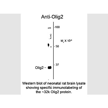Anti-Olig2 (Rabbit) Antibody, 100µL, Liquid