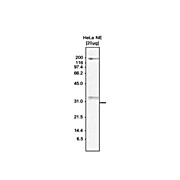Anti-SKI8 (RABBIT) Antibody, 150µg, Liquid (sterile filtered)