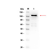Anti-BETA GALACTOSIDASE (E.coli) (RABBIT) Antibody Biotin Conjugated, 100µg, Lyophilized