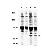 Anti-FANCF (RABBIT) Antibody, 100µg, Liquid (sterile filtered)
