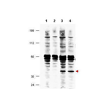 Anti-FANCF (RABBIT) Antibody, 100µg, Liquid (sterile filtered)