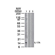 hu Anti-IL-17A Biotin [4H1524.1] 100µg
