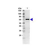 Anti-BOVINE SERUM ALBUMIN (RABBIT) Antibody, 100µg, Lyophilized