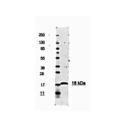 Anti-Human IL-1ß (RABBIT) Antibody Peroxidase Conjugated, 100µg, Lyophilized