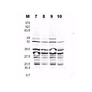Anti-RFA2 pS122 (RABBIT) Antibody, 100µg, Liquid (sterile filtered)