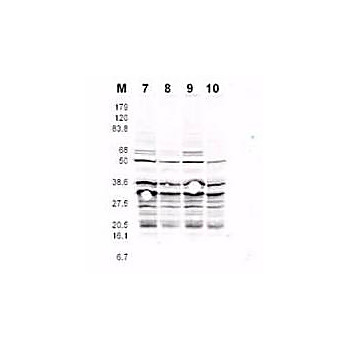 Anti-RFA2 pS122 (RABBIT) Antibody, 100µg, Liquid (sterile filtered)