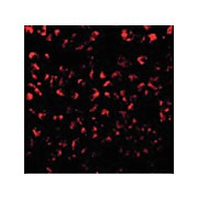 Anti-Eotaxin (RABBIT) Antibody, 100µg, Liquid (sterile filtered)