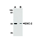 Anti-ENC-2 (CHICKEN) Antibody, 100µg, Liquid (sterile filtered)