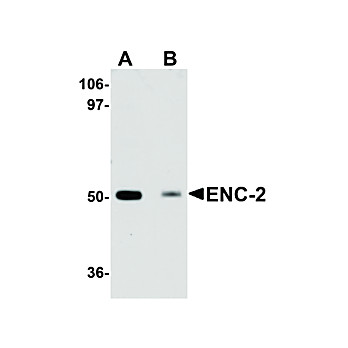Anti-ENC-2 (CHICKEN) Antibody, 100µg, Liquid (sterile filtered)