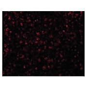CCR3 Antibody cterm 100µg