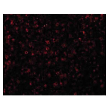 CCR3 Antibody cterm 100µg