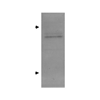 Anti-APOLIPOPROTEIN E (GOAT) Antibody, 500µg, Liquid (sterile filtered)