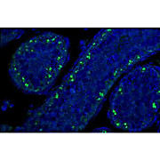 Anti-p19Arf (exon 2) (RAT) Monoclonal Antibody, 100µg, Liquid (sterile filtered)