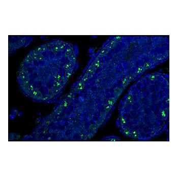 Anti-p19Arf (exon 2) (RAT) Monoclonal Antibody, 100µg, Liquid (sterile filtered)