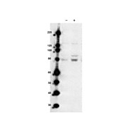 Anti-MARK2 pT595 (RABBIT) Antibody, 100µg, Liquid (sterile filtered)