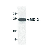 Anti-MD-2 (RABBIT) Antibody, 100µg, Liquid (sterile filtered)