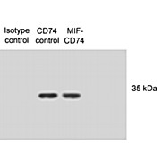 Anti-CD74 (MOUSE) Monoclonal Antibody, 100µg, Liquid (sterile filtered)