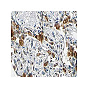 Anti-Human FANCG (RABBIT) Antibody, 100µg, Liquid (sterile filtered)