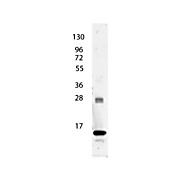 Anti-Human IL-3 (RABBIT) Antibody, 100µg, Lyophilized