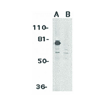 PID Antibody 100µg