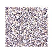 Anti-ATG5 (CHICKEN) Antibody, 100µg, Liquid (sterile filtered)