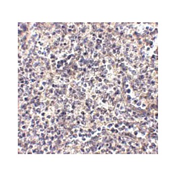 Anti-ATG5 (CHICKEN) Antibody, 100µg, Liquid (sterile filtered)