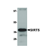 Anti-SIRT5 (CHICKEN) Antibody, 100µg, Liquid (sterile filtered)