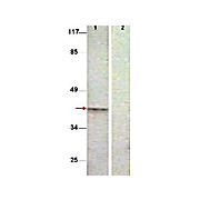 Anti-Aurora B pT232 (RABBIT) Antibody, 100µg, Liquid (sterile filtered)