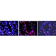 Anti-Mouse IL-1ß (RABBIT) Antibody, 100µg, Lyophilized