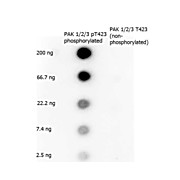 Anti-PAK 1/2/3 pT423 (RABBIT) Antibody, 100µg, Liquid (sterile filtered)