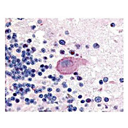 Anti-Huntington pS421 (RABBIT) Antibody, 100µg, Liquid (sterile filtered)