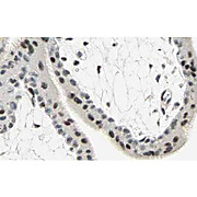 SMAD3 Antibody cterm 100µg