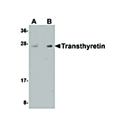 Anti-Transthyretin (CHICKEN) Antibody, 100µg, Liquid (sterile filtered)