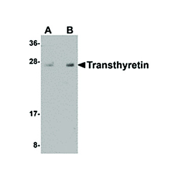 Anti-Transthyretin (CHICKEN) Antibody, 100µg, Liquid (sterile filtered)