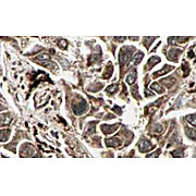 Anti-RFFL (RABBIT) Antibody, 500µg, Lyophilized