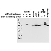 Anti-Selenophosphate Synthetase 2 (SPS2) (RABBIT) Antibody, 100µg, Liquid (sterile filtered)