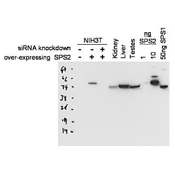 Anti-Selenophosphate Synthetase 2 (SPS2) (RABBIT) Antibody, 100µg, Liquid (sterile filtered)
