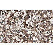 Anti-MAD2L2 (RABBIT) Antibody, 100µg, Liquid (sterile filtered)