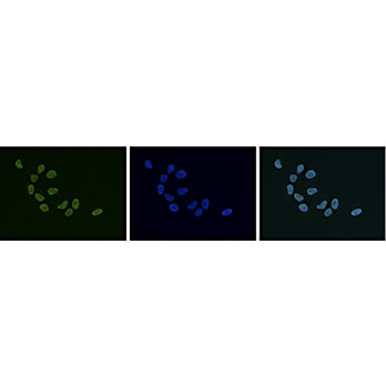 Anti-HP1 alpha, beta, gamma (RABBBIT) Antibody, 50µg, Liquid (sterile filtered)