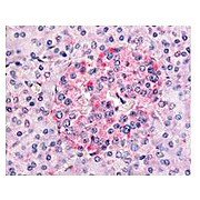 Anti-Human SGK-1 (Rabbit), 500µg, Liquid (sterile filtered)