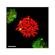 HSF1 Antibody [10H8] 100µg
