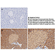 Anti-Mouse IL-6 (RABBIT) Antibody, 100µg, Lyophilized