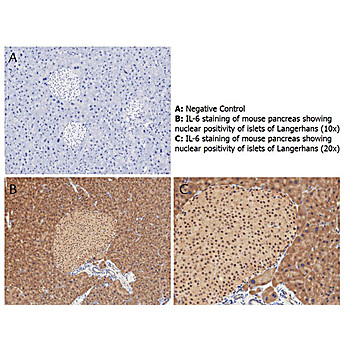Anti-Mouse IL-6 (RABBIT) Antibody, 100µg, Lyophilized