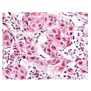 Anti-E2F-1 pS364 (RABBIT) Antibody, 100µg, Liquid (sterile filtered)