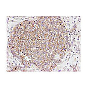 Anti-AKT pS473 (RABBIT) Antibody, 25µL, Liquid (sterile filtered)